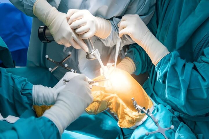 Robotic Knee Replacement Surgery